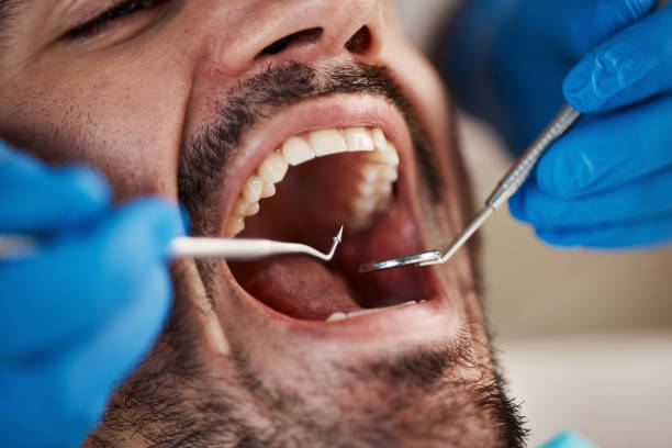 Best Emergency Dentist for Knocked-Out Tooth in Bluefield, VA