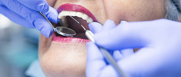Best Emergency Dental Care for Abscessed Tooth in Bluefield, VA